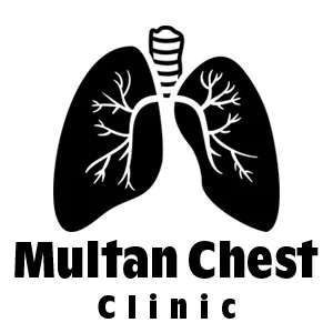Multan-Chest-Clinic